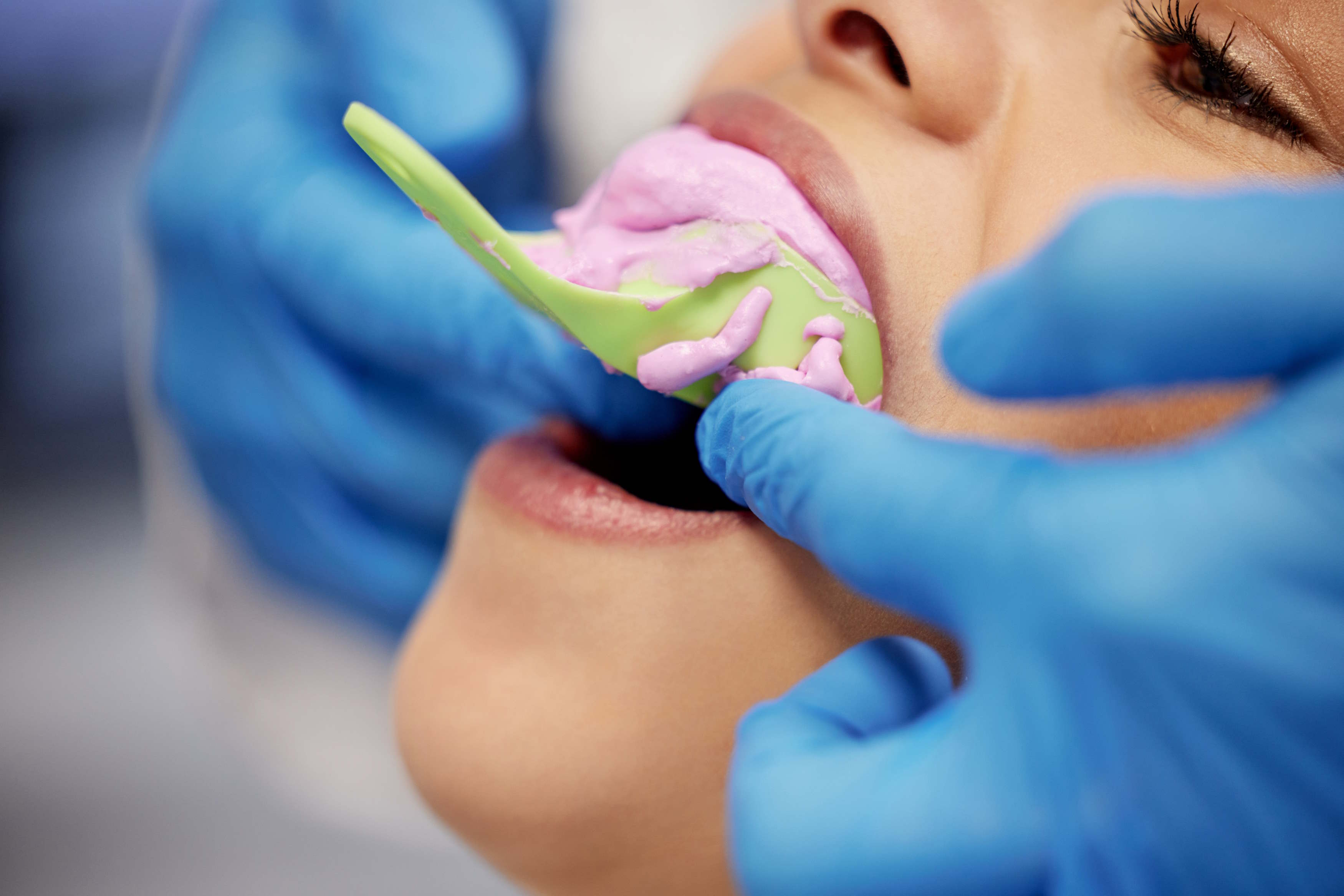 Ceramic crowns - new 1