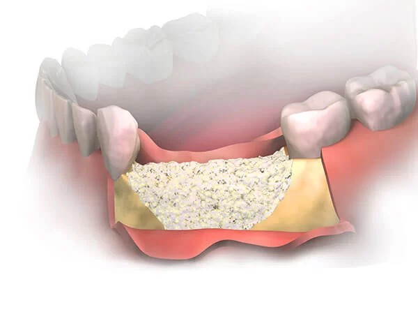 The jaw section